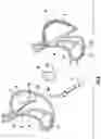 Fig. 07 - Devices and methods facilitating sleeve gastrectomy procedures