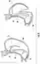 Fig. 09 - Devices and methods facilitating sleeve gastrectomy procedures