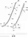 Fig. 28 - Devices and methods facilitating sleeve gastrectomy procedures