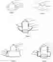 Fig. 02 - CONDOM WITH WRAPPING ADHESIVE FLANGES