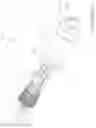 Fig. 08 - Tissue removal devices, systems and methods