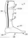 Fig. 01 - Compression sleeve