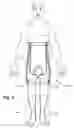 Fig. 09 - Adjustable orthostatic intolerance system and garment