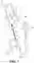 Fig. 08 - DECOMPRESSION DEVICE