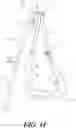 Fig. 15 - DECOMPRESSION DEVICE