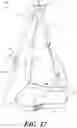 Fig. 18 - DECOMPRESSION DEVICE
