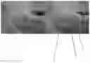 Fig. 01 - ORAL CARE PARTICLES AND SYSTEM FOR THE ADMINISTRATION THEREOF