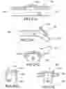 Fig. 20 - AEROSOL DELIVERY SYSTEMS, COMPOSITIONS AND METHODS