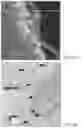 Fig. 03 - Vaccine nanotechnology