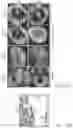 Fig. 23 - Vaccine nanotechnology