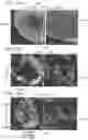 Fig. 26 - Vaccine nanotechnology