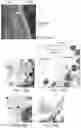 Fig. 29 - Vaccine nanotechnology