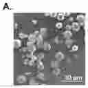 Fig. 01 - FORMULATION FOR PROTECTION THROUGH CONTROLLED RELEASE OF MICROPARTICLES CONTAINING RECOMBINANT OUTER MEMBRANE VESICLES