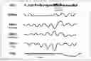 Fig. 01 - Methods and compositions for treating sleep apnea