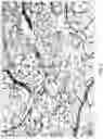 Fig. 03 - Gap junction intercellular communication modulators and their use for the treatment of diabetic eye disease
