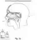 Fig. 03 - Nasal compositions and method of use thereof