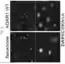 Fig. 13 - Anticancer compositions and methods for making and using them