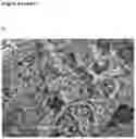 Fig. 06 - Treatment for periodontitis