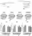 Fig. 01 - Compositions and methods for gene editing in T cells using CRISPR/Cpf1