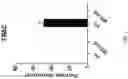 Fig. 11 - Compositions and methods for gene editing in T cells using CRISPR/Cpf1