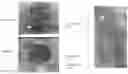 Fig. 01 - NON-MESENCHYMAL HUMAN LUNG STEM CELLS AND METHODS OF THEIR USE FOR TREATING RESPIRATORY DISEASES