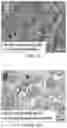 Fig. 02 - Tissue constructs including pancreas derived microvessel fragments and related methods