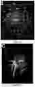 Fig. 10 - Tissue constructs including pancreas derived microvessel fragments and related methods