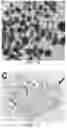 Fig. 13 - Tissue constructs including pancreas derived microvessel fragments and related methods