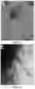 Fig. 14 - Tissue constructs including pancreas derived microvessel fragments and related methods