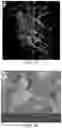 Fig. 15 - Tissue constructs including pancreas derived microvessel fragments and related methods