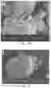 Fig. 16 - Tissue constructs including pancreas derived microvessel fragments and related methods