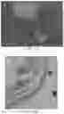 Fig. 17 - Tissue constructs including pancreas derived microvessel fragments and related methods