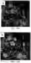Fig. 20 - Tissue constructs including pancreas derived microvessel fragments and related methods