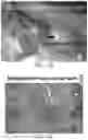 Fig. 22 - Tissue constructs including pancreas derived microvessel fragments and related methods