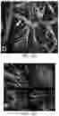 Fig. 23 - Tissue constructs including pancreas derived microvessel fragments and related methods