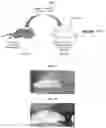 Fig. 02 - Methods of treating systemic graft-versus-host disease with extracellular vesicles