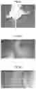 Fig. 03 - Methods of treating systemic graft-versus-host disease with extracellular vesicles
