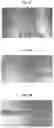Fig. 04 - Methods of treating systemic graft-versus-host disease with extracellular vesicles
