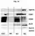 Fig. 17 - Methods of treating systemic graft-versus-host disease with extracellular vesicles