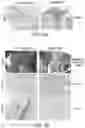 Fig. 05 - Topical composition, pharmaceutical composition containing inactivated culture and method of facilitating wound healing and scar reduction using the same