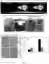Fig. 07 - Targeted nanoparticle conjugates