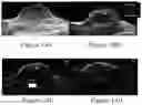 Fig. 14 - Nanoparticle Photoacoustic Imaging Agents