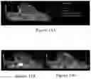 Fig. 15 - Nanoparticle Photoacoustic Imaging Agents