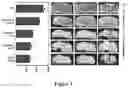 Fig. 04 - HDAC6 inhibitors and imaging agents