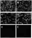 Fig. 01 - Therapeutic material