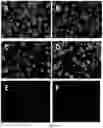 Fig. 03 - Therapeutic material