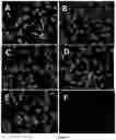 Fig. 04 - Therapeutic material