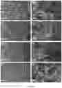 Fig. 07 - Therapeutic material