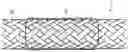 Fig. 01 - Autonomously growing implantable device
