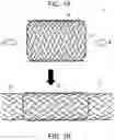 Fig. 02 - Autonomously growing implantable device